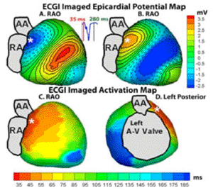 Imagen: El ECGI hace mapa del corazón (Foto cortesía de la Universidad de Washington en St. Louis).